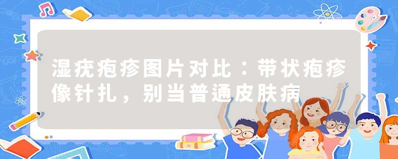湿疣疱疹图片对比：带状疱疹像针扎，别当普通皮肤病